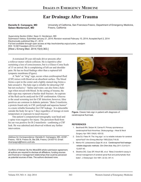 Ear Drainage After Trauma